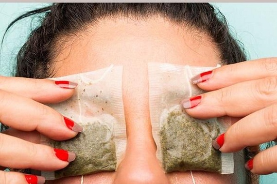 Caffeine in soaked tea bags cures puffy eyes | Girlfriend is Better